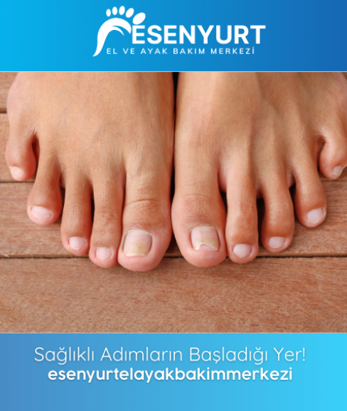 Kalınlaşmış Tırnak
