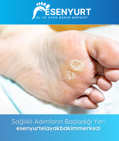 Nasır Bakımı